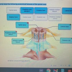 Label anatomical features correctly following cerebellum structures nearby solved superior medulla transcribed problem text been show has colliculus